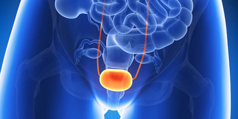Treatment of bladder inflammation with tablets